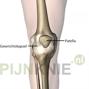Image 1: knieschijf