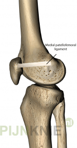 Image 2: mpfl-knie1